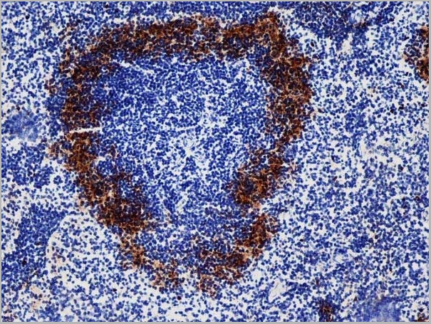 product-image-AAA12262_IHC2.jpg