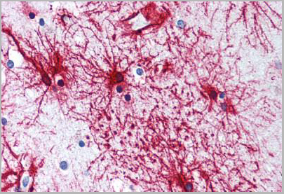 product-image-AAA12316_IHC.jpg