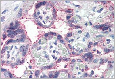product-image-AAA12317_IHC.jpg