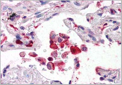 product-image-AAA12318_IHC.jpg