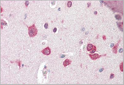 product-image-AAA12321_IHC2.jpg
