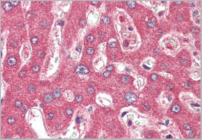product-image-AAA12321_IHC3.jpg