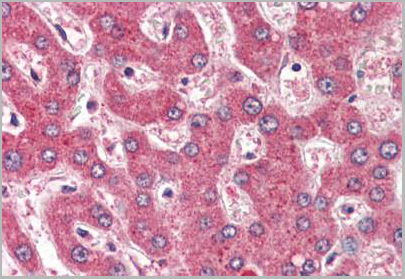 product-image-AAA12322_IHC.jpg