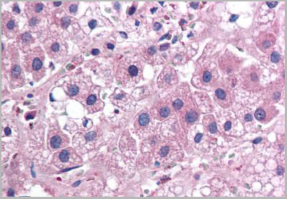 product-image-AAA12340_IHC.jpg