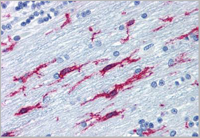 product-image-AAA12341_IHC.jpg