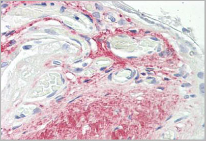 product-image-AAA12357_IHC.jpg