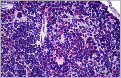 product-image-AAA12360_IHC.jpg