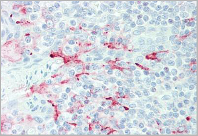 product-image-AAA12374_IHC.jpg