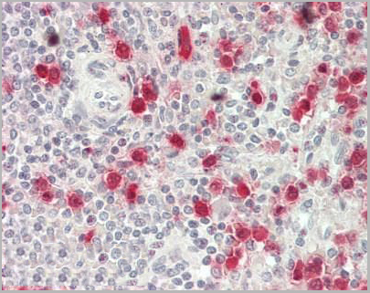 product-image-AAA12380_IHC.jpg