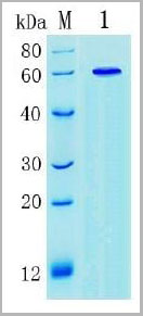 product-image-AAA13292_SDS_PAGE.jpg