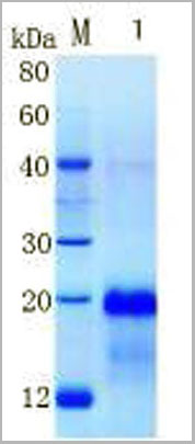 product-image-AAA13293_SDS_PAGE.jpg