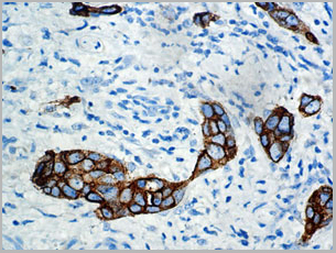 product-image-AAA13555_IHC3.jpg