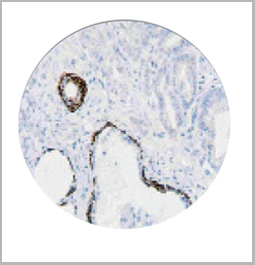 product-image-AAA13557_IHC3.jpg