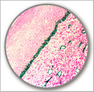 product-image-AAA13558_IHC.jpg