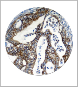 product-image-AAA13559_IHC.jpg