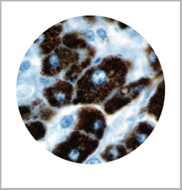 product-image-AAA13560_IHC2.jpg