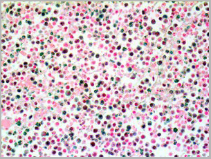 product-image-AAA13561_IHC.jpg