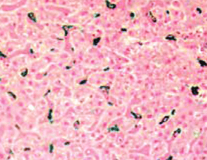 product-image-AAA13562_IHC2.jpg