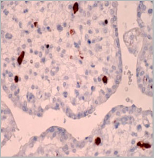 product-image-AAA13563_IHC3.jpg