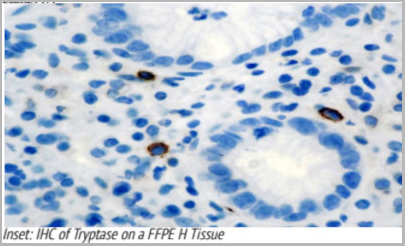 product-image-AAA13565_IHC.jpg