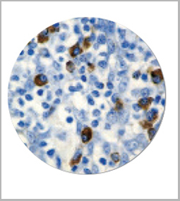 product-image-AAA13566_IHC2.jpg