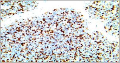 product-image-AAA13568_IHC.jpg