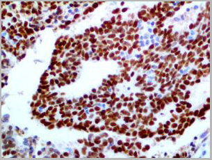 product-image-AAA13571_IHC2.jpg