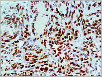 product-image-AAA13573_IHC2.jpg