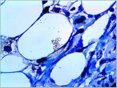 product-image-AAA13576_IHC2.jpg