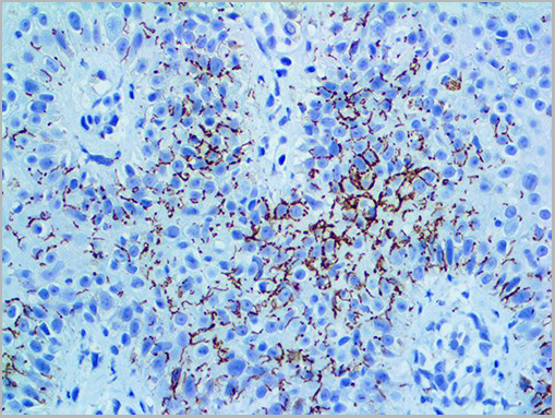 product-image-AAA13577_IHC2.jpg