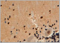 product-image-AAA13649_IHC2.jpg