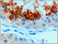 product-image-AAA13650_IHC2.jpg