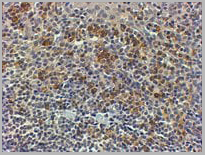 product-image-AAA13652_IHC2.jpg