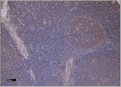 product-image-AAA13654_IHC2.jpg