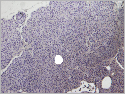 product-image-AAA13655_IHC3.jpg