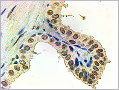 product-image-AAA13656_IHC2.jpg