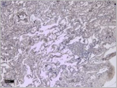product-image-AAA13659_IHC3.jpg