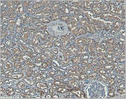 product-image-AAA13661_IHC4.jpg