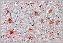 product-image-AAA13663_IHC2.jpg