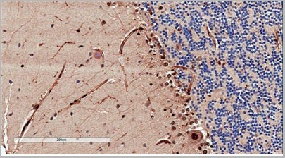 product-image-AAA13668_IHC3.jpg