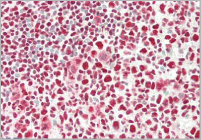 product-image-AAA13673_IHC2.jpg