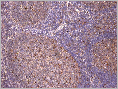 product-image-AAA13673_IHC5.jpg