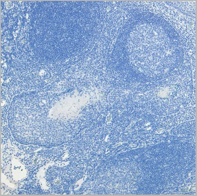 product-image-AAA13673_IHC6.jpg