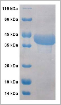 product-image-AAA13692_SDS_PAGE.jpg
