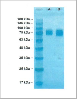 product-image-AAA13696_SDS_PAGE.jpg