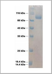 product-image-AAA13697_SDS_PAGE.jpg