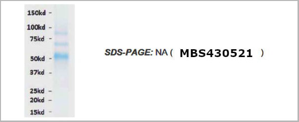 product-image-AAA13701_SDS_PAGE.jpg