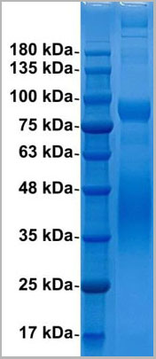 product-image-AAA13703_SDS_PAGE.jpg