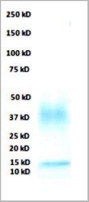 product-image-AAA13704_SDS_PAGE.jpg