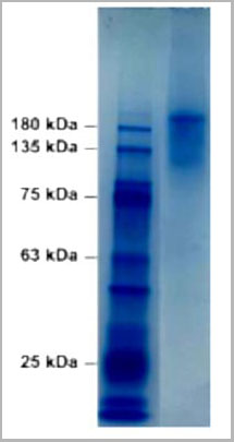 product-image-AAA13704_SDS_PAGE3.jpg
